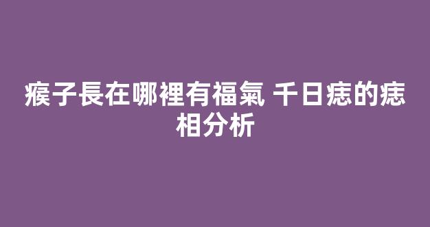瘊子長在哪裡有福氣 千日痣的痣相分析